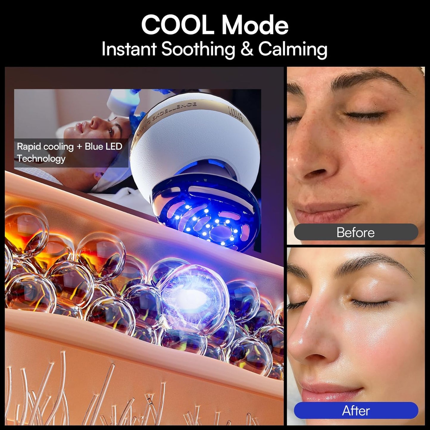 INIA SPHERA 8-in-1 Microcurrent Facial Device - Red Light & Cooling Tool for At-Home Skin Care | 5 Custom Modes
