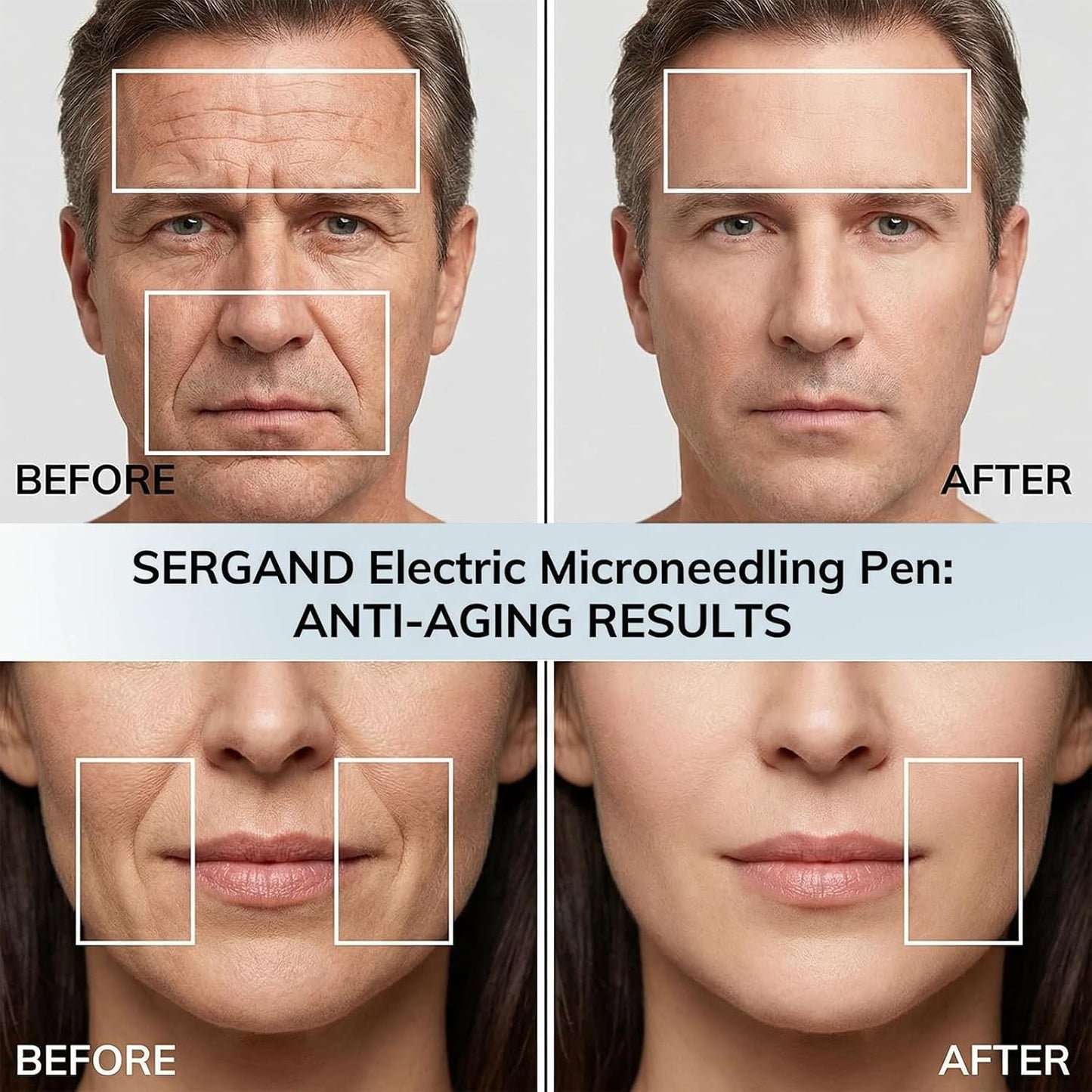 Derma Roller - 0.25mm Microneedling Beauty Tool for Home Use | Skin Care for Women & Men
