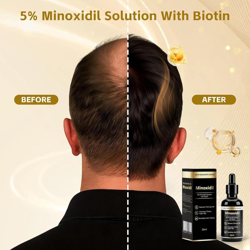Minoxidil Essence 5% - Hair & Beard Growth Serum for Men & Women | Strengthens Roots & Activates Follicles, 1.76 fl oz - Black