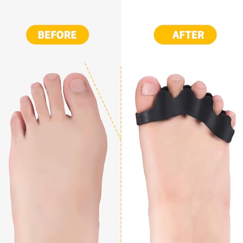 Threlaco Adjustable Silicone Toe Spacers for Foot Alignment & Recovery