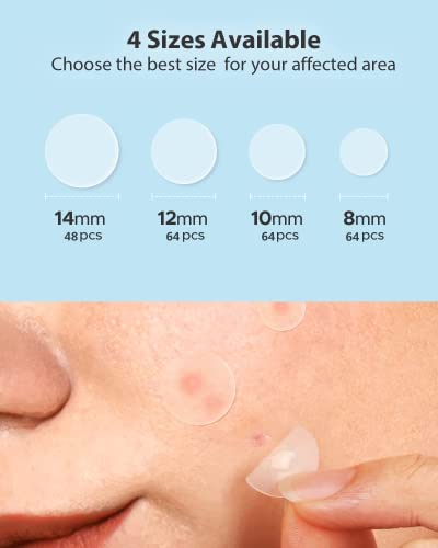 LitBear 360 Count Acne Pimple Patches - Day & Night Hydrocolloid Zit Stickers with Witch Hazel, Tea Tree & Calendula Oil, Multiple Sizes