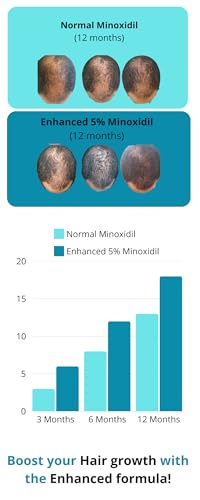 Minoxidil 5% Hair Growth Solution for Men and Women - 2.1 fl oz