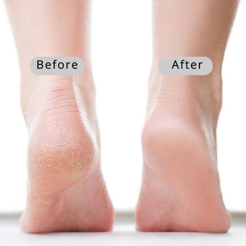 Curved Handle Pumice Stone - Ergonomic Foot Scrubber for Smooth Feet