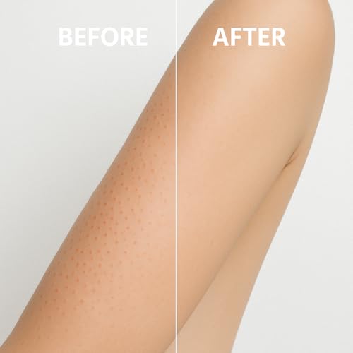 Microdermabrasion Exfoliating Bar Soap for KP & Body Acne