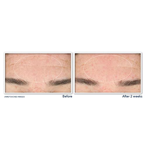 RoC Derm Correxion Serum Facial Cleanser with Niacinamide - 6 oz