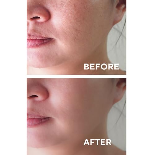 The Ceel AHA BHA Facial Peeling Serum - 10% AHA, 2% BHA, 30ml