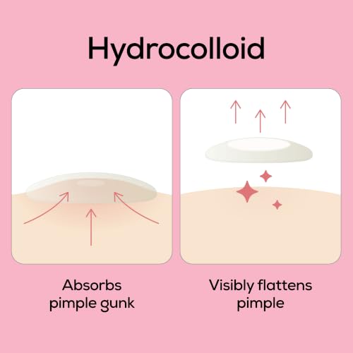 HANHOO Hydrocolloid Blemish Patch - 108 Count Acne Spot Patches