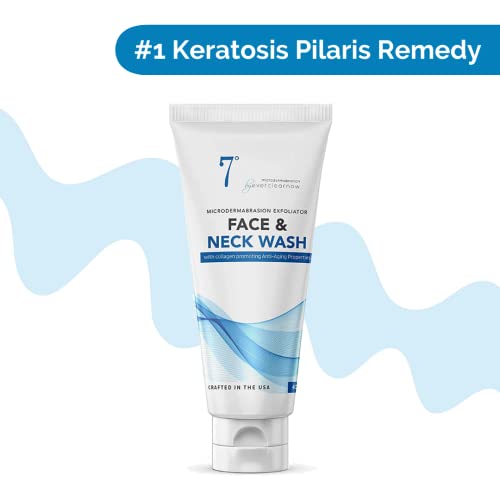 Microdermabrasion Face Scrub for Keratosis Pilaris & Acne - Deep Cleansing Exfoliant
