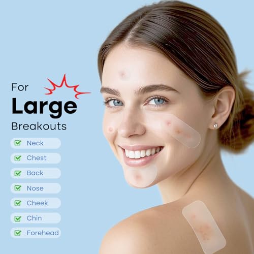 Breiboz Red Large Acne Patches with Tea Tree & Salicylic Acid, 484 Hydrocolloid Bandages for Face & Body