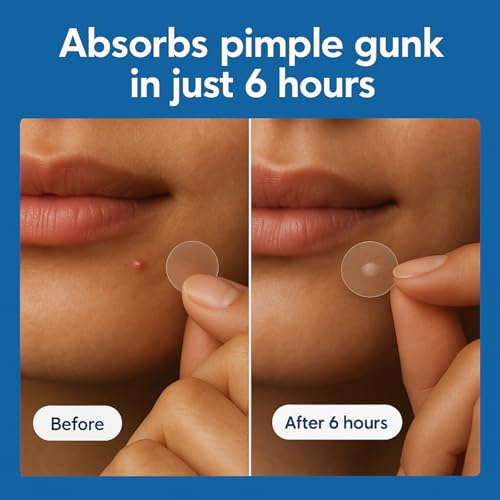 CLEARI Pimple Patches - 72 Ultra-Thin Acne Spot Covers