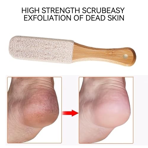 2-Pack Professional Pedicure Foot File with Wooden Handle