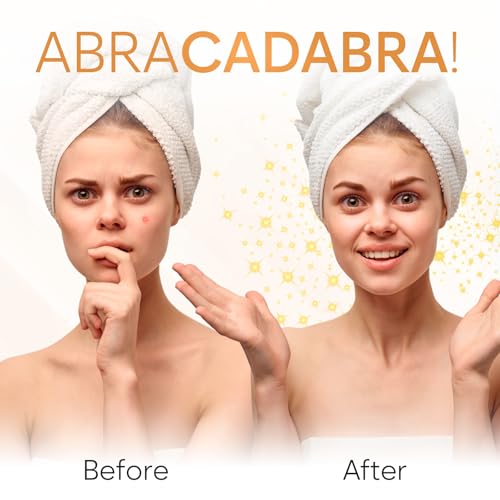AURAE Hydrocolloid Pimple Patches Variety Pack - 321 Invisible Acne Patches in 6 Shapes