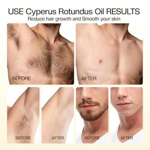 Cyperus Rotundus Oil for Hair Removal & Skin Care - 2 Pack
