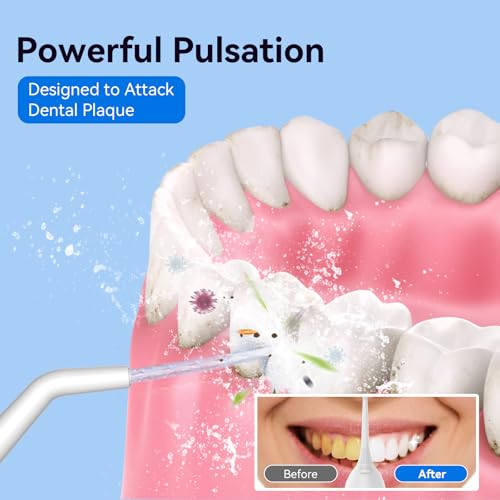 Goopick Cordless Water Flosser, Portable Oral Irrigator with 300ML Tank
