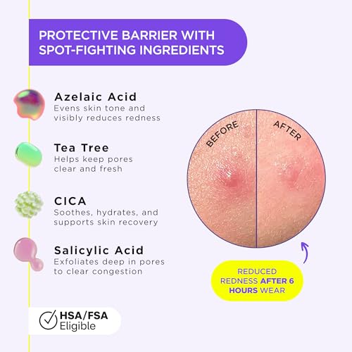 ZitSticka Liquid Pimple Patch - Invisible Acne Treatment, 10ml