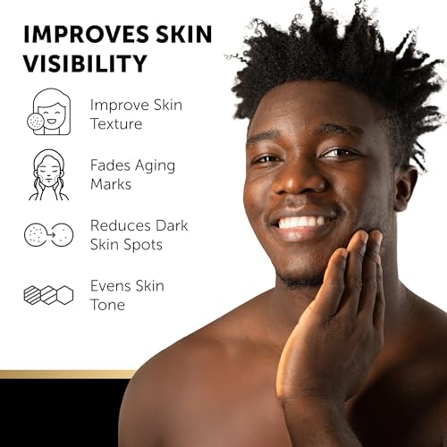VALITIC Kojic Acid Soap Bars with Vitamin C & Retinol - 2 Pack for Dark Spots