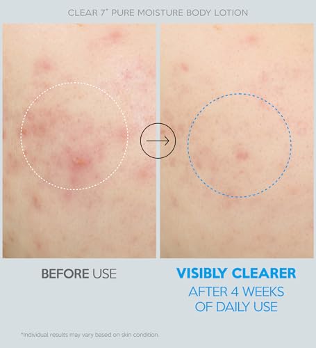 Troubless CLEAR 7 Plus Moisture Body Lotion for Sensitive Skin - 16.9 fl oz