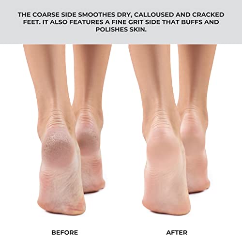 Stainless Steel Pedicure Foot File Coarse & Fine Grit - Professional Callus Remover