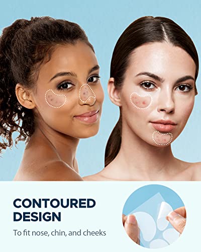 LitBear Large Acne Pimple Patches - 100 Count Hydrocolloid Stickers