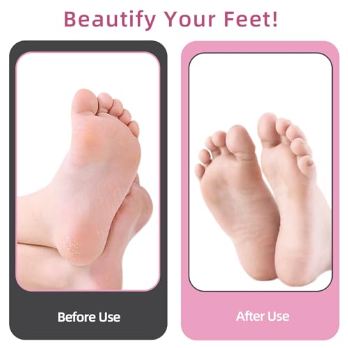 APRELM Electric Foot Callus Remover in Rose Pink - 80 Sandpaper Discs, Adjustable Speed