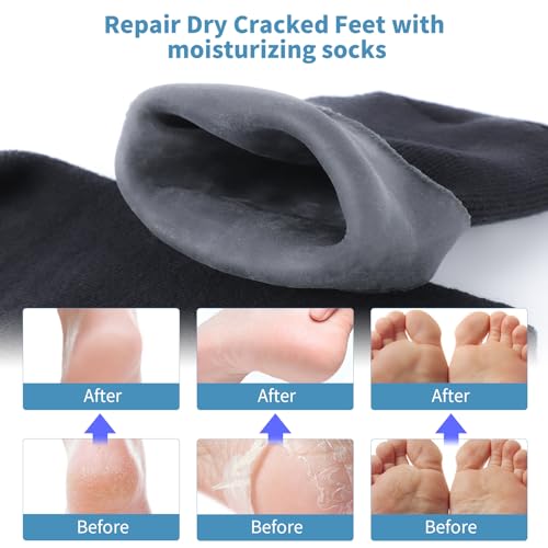 ALUROICE 11in Large Silicone Moisturizing Socks for Men, Black, 1 Pair (L)