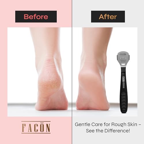 FACON Professional Callus Shaver with 50 Blades for Feet & Hands