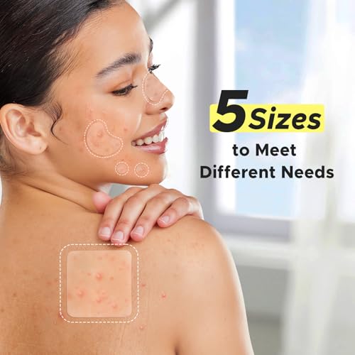 LitBear Large Pimple Patches - XL Hydrocolloid Acne Stickers (228 Count)