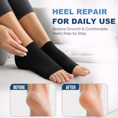 OKbutler Moisturizing Heel Socks for Cracked Heels - 2 Pairs
