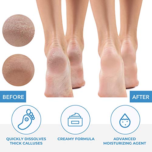 ForPro Premium Callus No More! Fast-Acting Callus Remover, 32 oz.