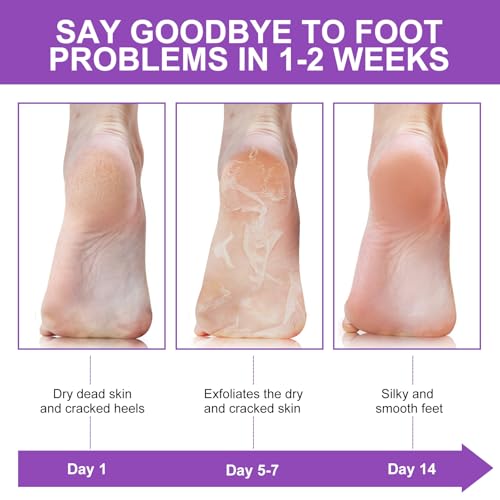Liefiet Lavender Foot Peeling Mask 5 Pack – Exfoliating Foot Care