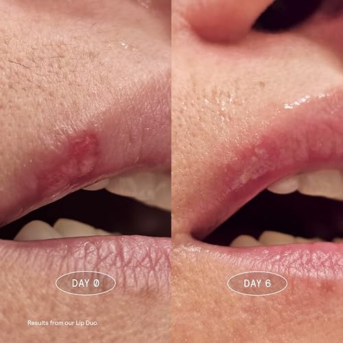 MARK Los Angeles Lip Health Balm - Nourishing Treatment for Dry Lips