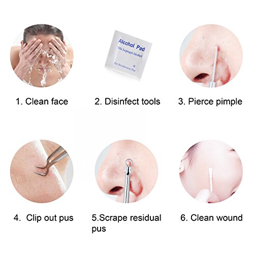 FIXBODY Stainless Steel Blackhead & Splinter Remover Tool Kit - Pimple, Ingrown Hair, Acne, Comedone Extraction Tweezers