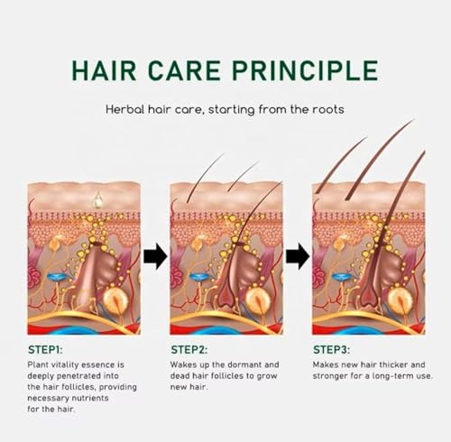 Hair Growth Spray for Stronger Hair & Beard – Natural DHT Blocker