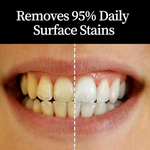 KeLeek Activated Charcoal Hydroxyapatite Toothpaste for Sensitive Teeth