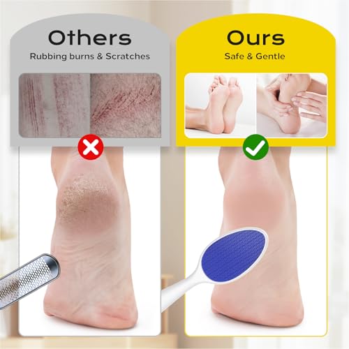 yomanta Nano Glass Foot File - 2-in-1 Callus Remover & Exfoliator