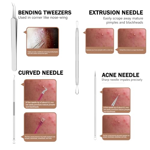15-Piece Blackhead Remover Tool Kit - Stainless Steel Pimple Extractor