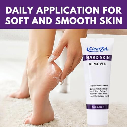 Clearzal Foot Cream for Hard Skin Callus & Corn Removal 3.4oz
