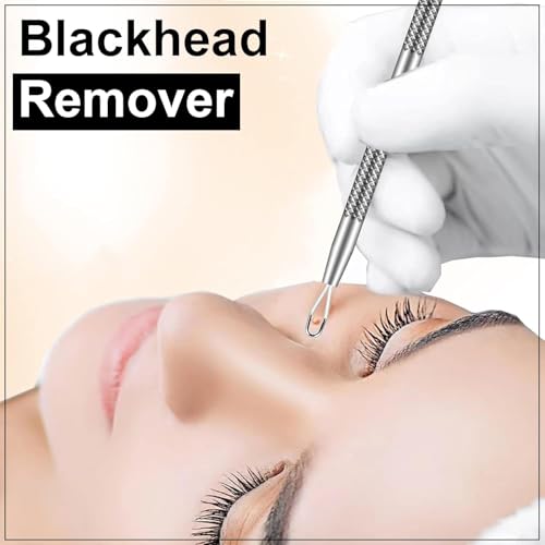 Professional Stainless Steel Blackhead Remover Kit for Acne & Blemish Care