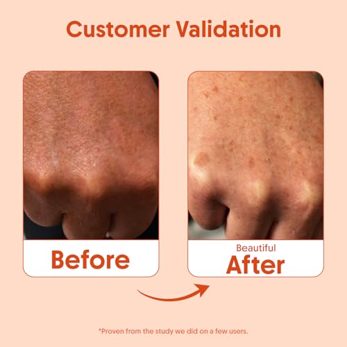 Aravi Organic SPF 50 Water-Resistant Body Sunscreen Lotion 3.38 oz - Vegan Reef Safe Niacinamide Hyaluronic Acid