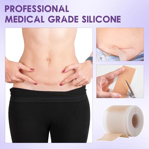 HONGYUNDA 2pcs Silicone Scar Tape for Skin Scar & Wrinkle Reduction