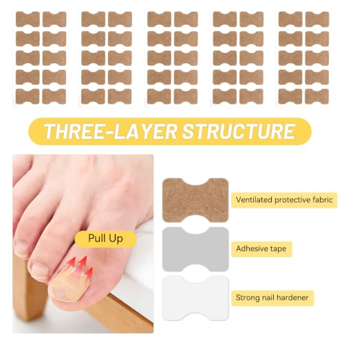 Ingrown Toenail Treatment Kit - Painless Home Care Set