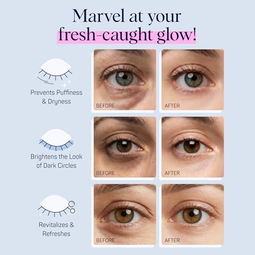 SpaLife Sardines Under Eye Patches with Niacinamide & Hyaluronic 8 Pairs — Fresh Catch Hydrogels