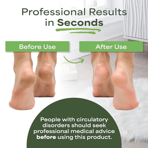 Pedi-wise Extra Large Double Sided Pumice Stone Foot File & Callus Remover - Model 1