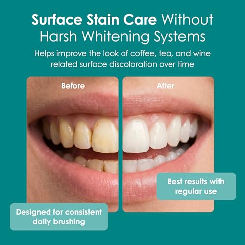 Wellnesse Hydroxyapatite Whitening Toothpaste 4 Oz - Fluoride Free, Fresh Mint, Enamel Care