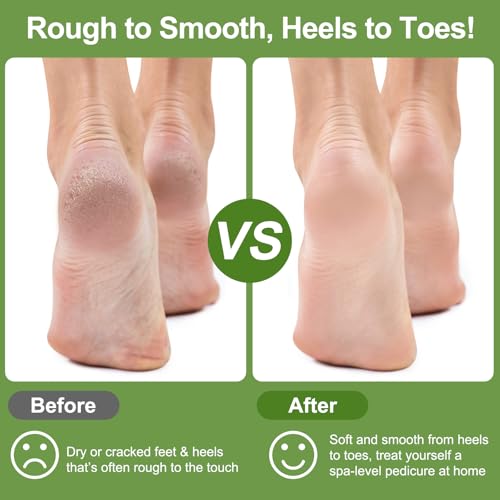 Natural Pumice Stone Set for Feet - 3 Pack Exfoliation Tools