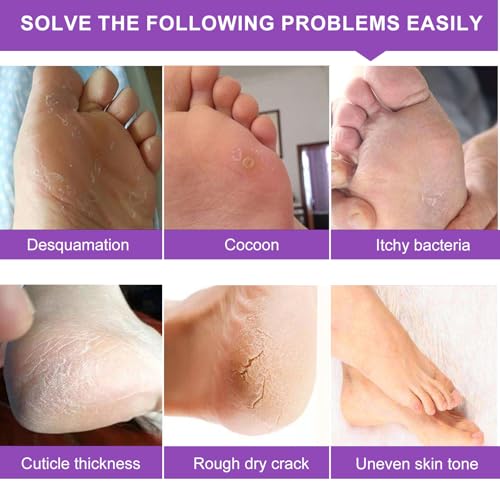 Liefiet Lavender Foot Peeling Mask 5 Pack – Exfoliating Foot Care