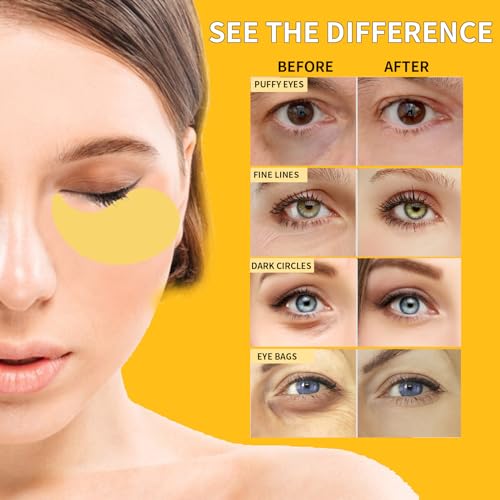 24K Gold Eye Masks for Dark Circles & Puffiness - 70PCS