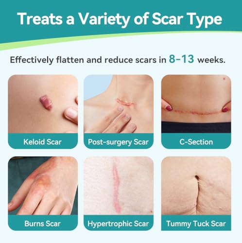 Dimora Medical Grade Silicone Scar Sheets - Ultra Soft Tape 1.6” x 60