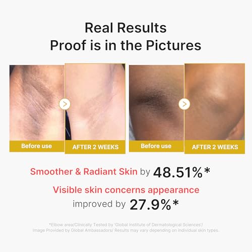 medicube Body Peel Shot with Kojic Acid and Turmeric | Gentle Body Brightening & Exfoliating Serum with BHA, LHA & PHA for Dead Skin Cells, Uneven Looking Skin & Excess Sebum | 9.46 fl.oz