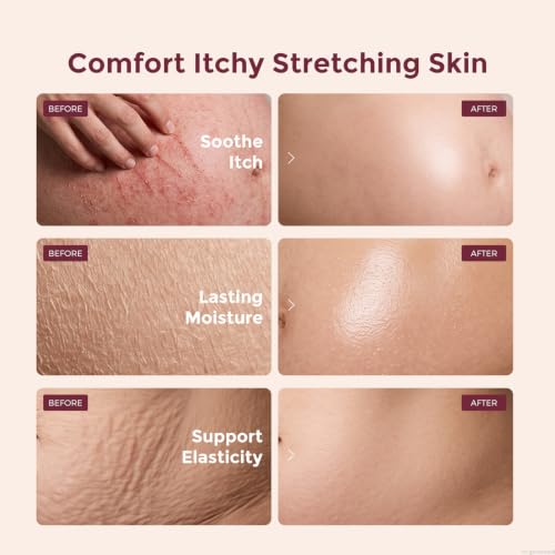 Momcozy Pregnancy Stretch Mark Cream | Hydrating Belly Lotion 1.06 oz